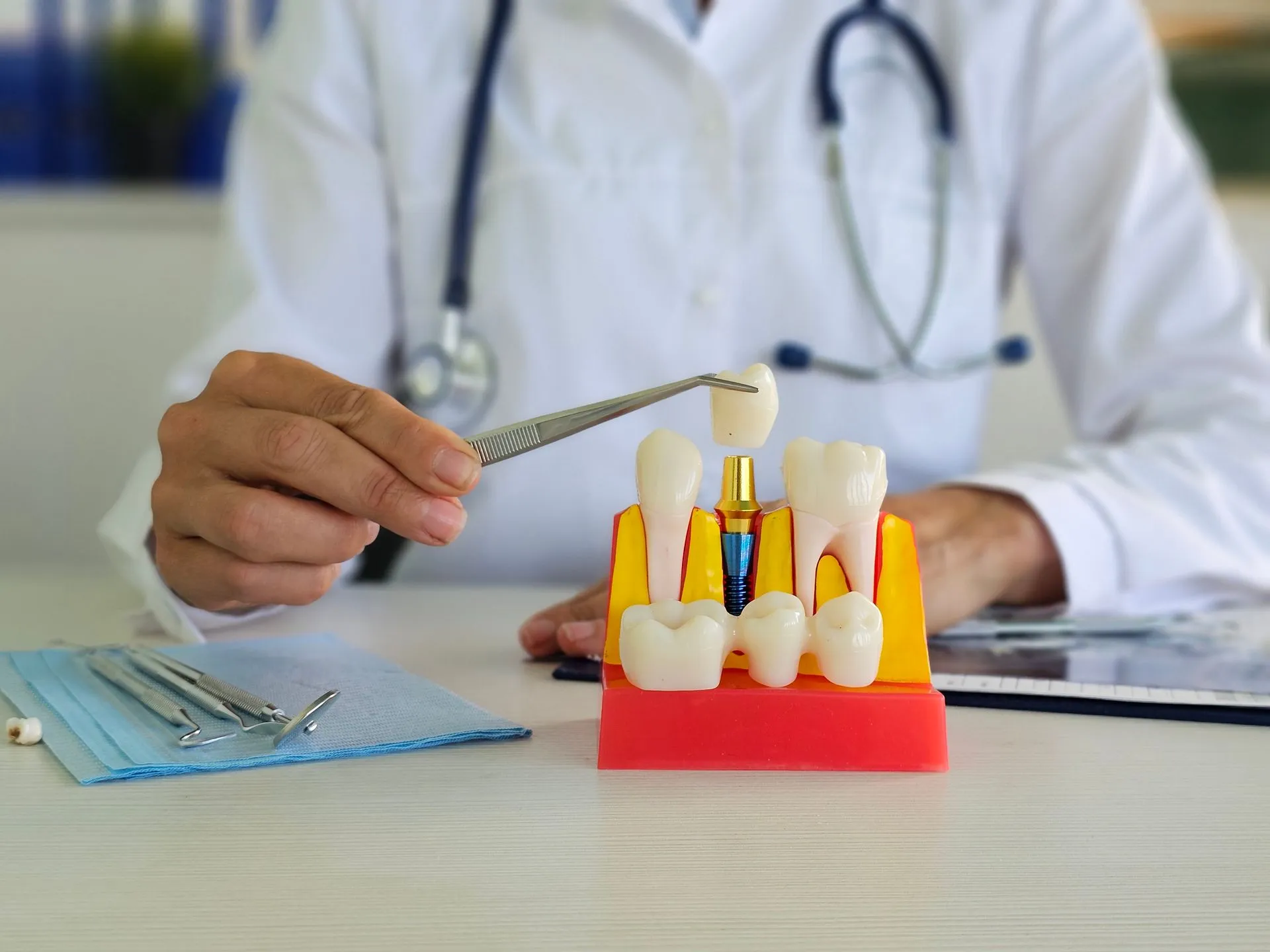 Alcan Family Dental, Same Day Dental Crown Anchorage AK, Family Dental Clinic Anchorage AK, Emergency Dental Care Anchorage AK, Emergency Dental Services Anchorage AK, Dentist Office Anchorage AK, Anchorage Dentures Medicaid, Emergency Dentures Anchorage