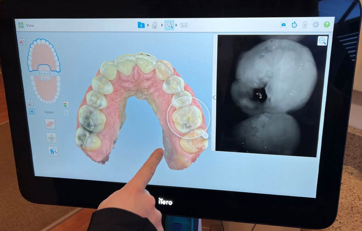 Alcan Family Dental, Same Day Dental Crown Anchorage AK, Family Dental Clinic Anchorage AK, Emergency Dental Care Anchorage AK, Emergency Dental Services Anchorage AK, Dentist Office Anchorage AK, Anchorage Dentures Medicaid, Emergency Dentures Anchorage