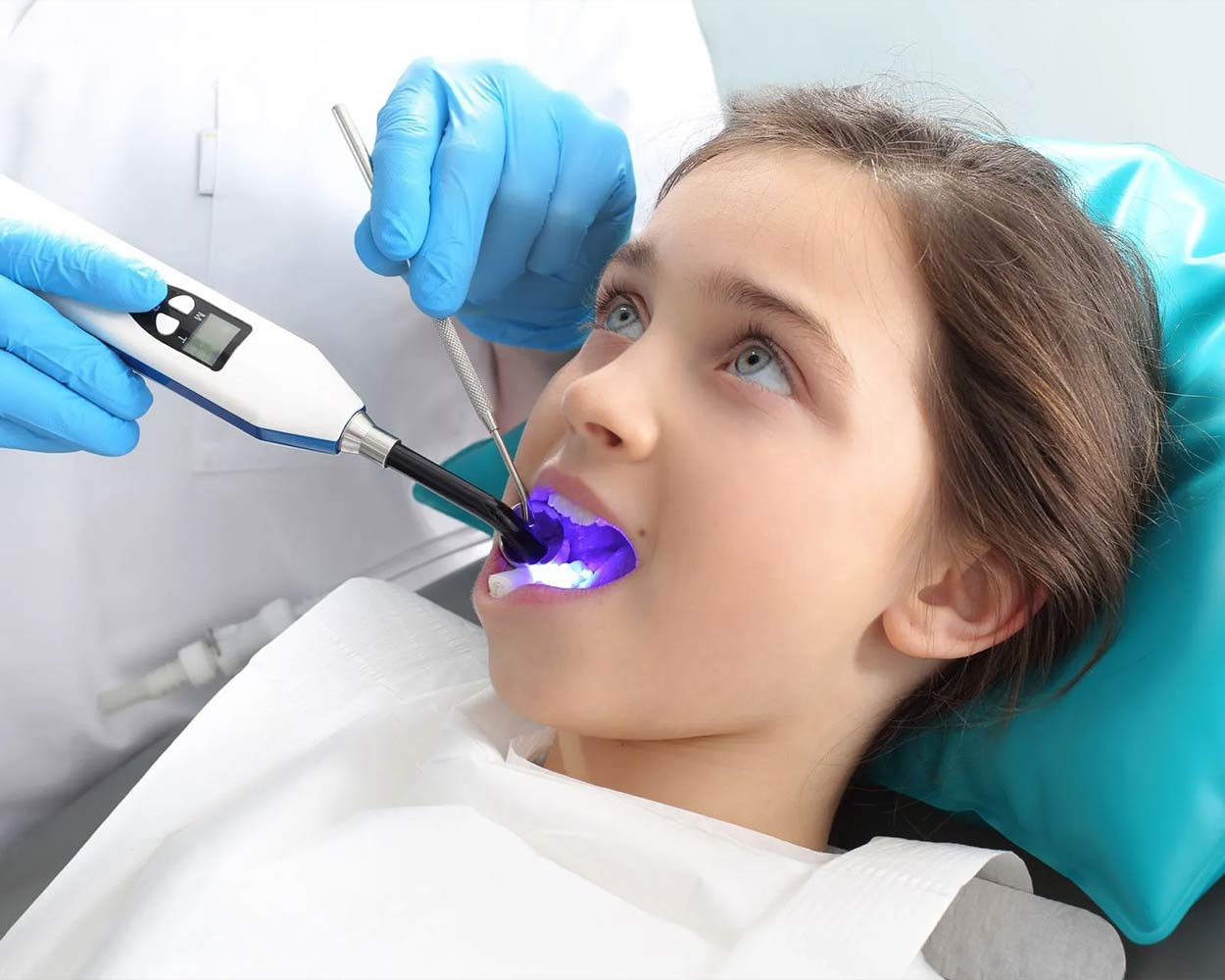 Dental Sealants Alcan Family Dental, Same Day Dental Crown Anchorage AK, Family Dental Clinic Anchorage AK, Emergency Dental Care Anchorage AK, Emergency Dental Services Anchorage AK, Dentist Office Anchorage AK, Anchorage Dentures Medicaid, Emergency Dentures Anchorage