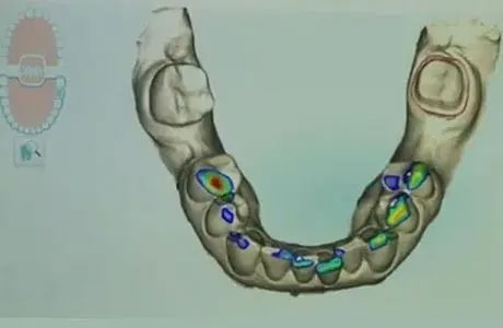 Alcan Family Dental, Same Day Dental Crown Anchorage AK, Family Dental Clinic Anchorage AK, Emergency Dental Care Anchorage AK, Emergency Dental Services Anchorage AK, Dentist Office Anchorage AK, Anchorage Dentures Medicaid, Emergency Dentures Anchorage