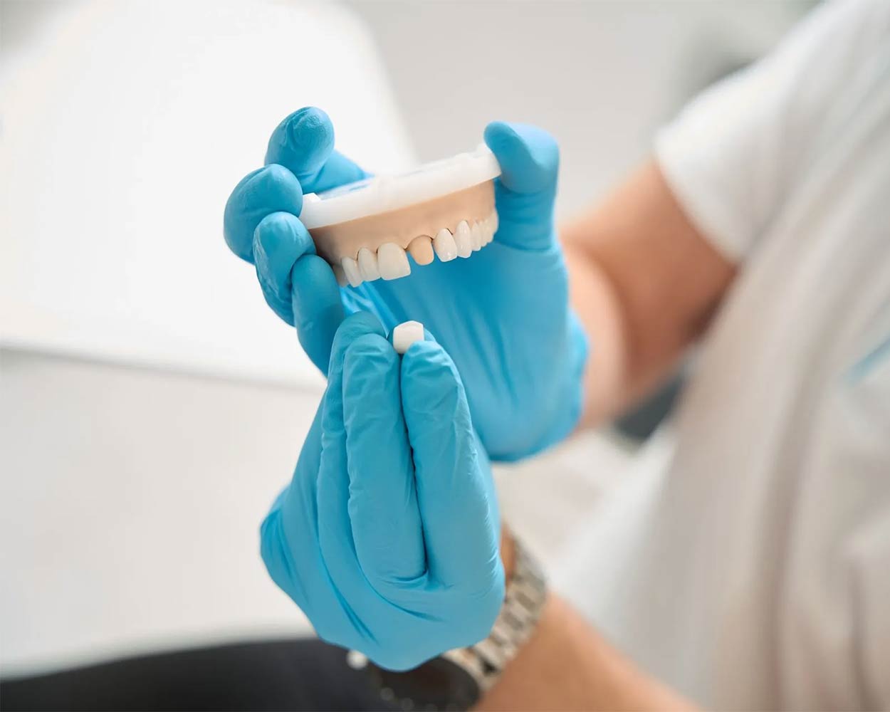 Alcan Family Dental, Same Day Dental Crown Anchorage AK, Family Dental Clinic Anchorage AK, Emergency Dental Care Anchorage AK, Emergency Dental Services Anchorage AK, Dentist Office Anchorage AK, Anchorage Dentures Medicaid, Emergency Dentures Anchorage
