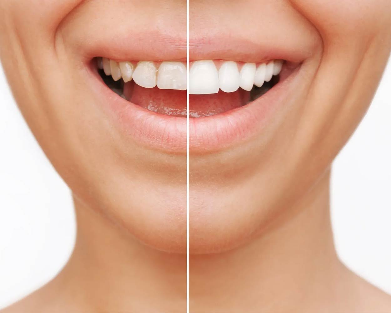 Alcan Family Dental, Same Day Dental Crown Anchorage AK, Family Dental Clinic Anchorage AK, Emergency Dental Care Anchorage AK, Emergency Dental Services Anchorage AK, Dentist Office Anchorage AK, Anchorage Dentures Medicaid, Emergency Dentures Anchorage