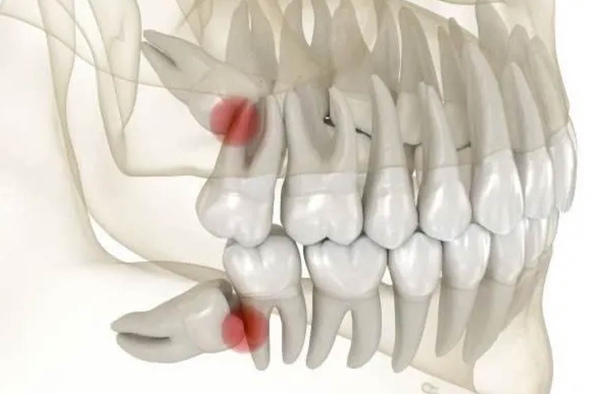 Alcan Family Dental, Same Day Dental Crown Anchorage AK, Family Dental Clinic Anchorage AK, Emergency Dental Care Anchorage AK, Emergency Dental Services Anchorage AK, Dentist Office Anchorage AK, Anchorage Dentures Medicaid, Emergency Dentures Anchorage